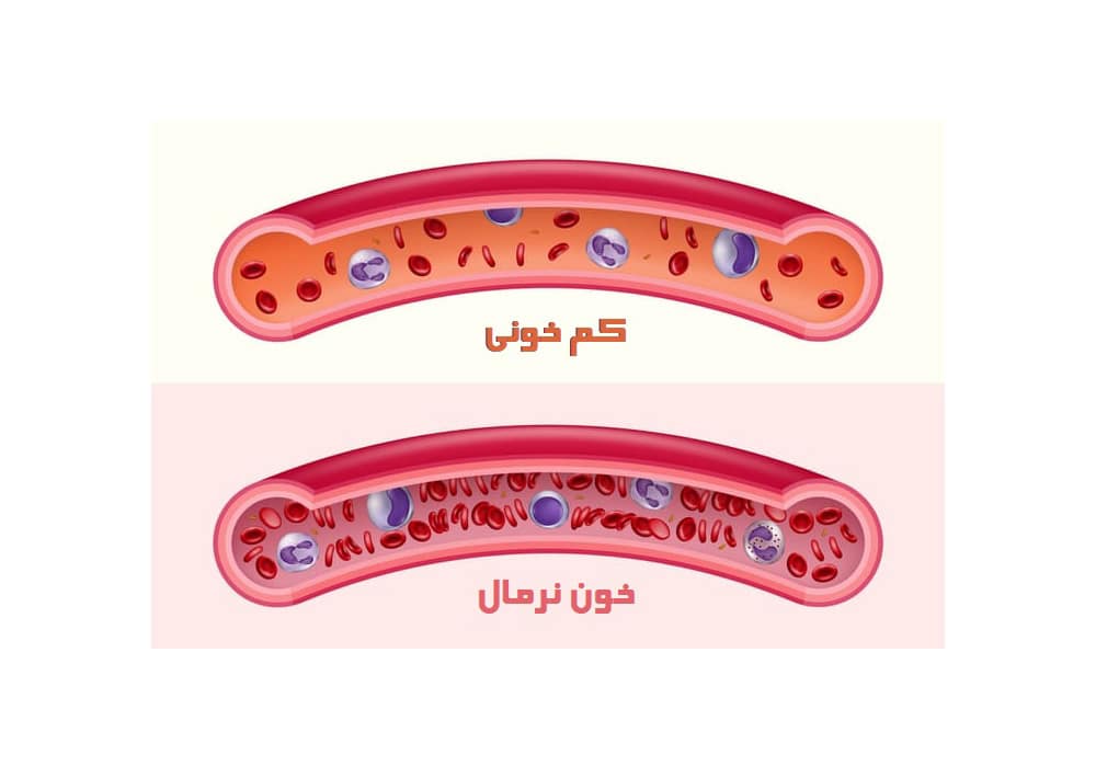 کشمش و تاثیر آن در سلامت زنان و پیشگیری از بیماری‌ها